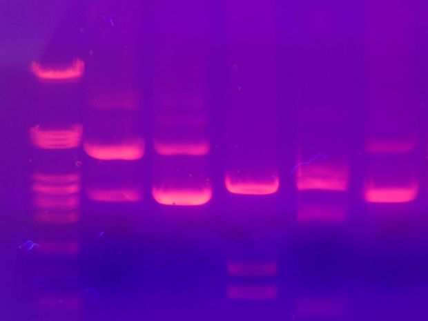 electrophoresis